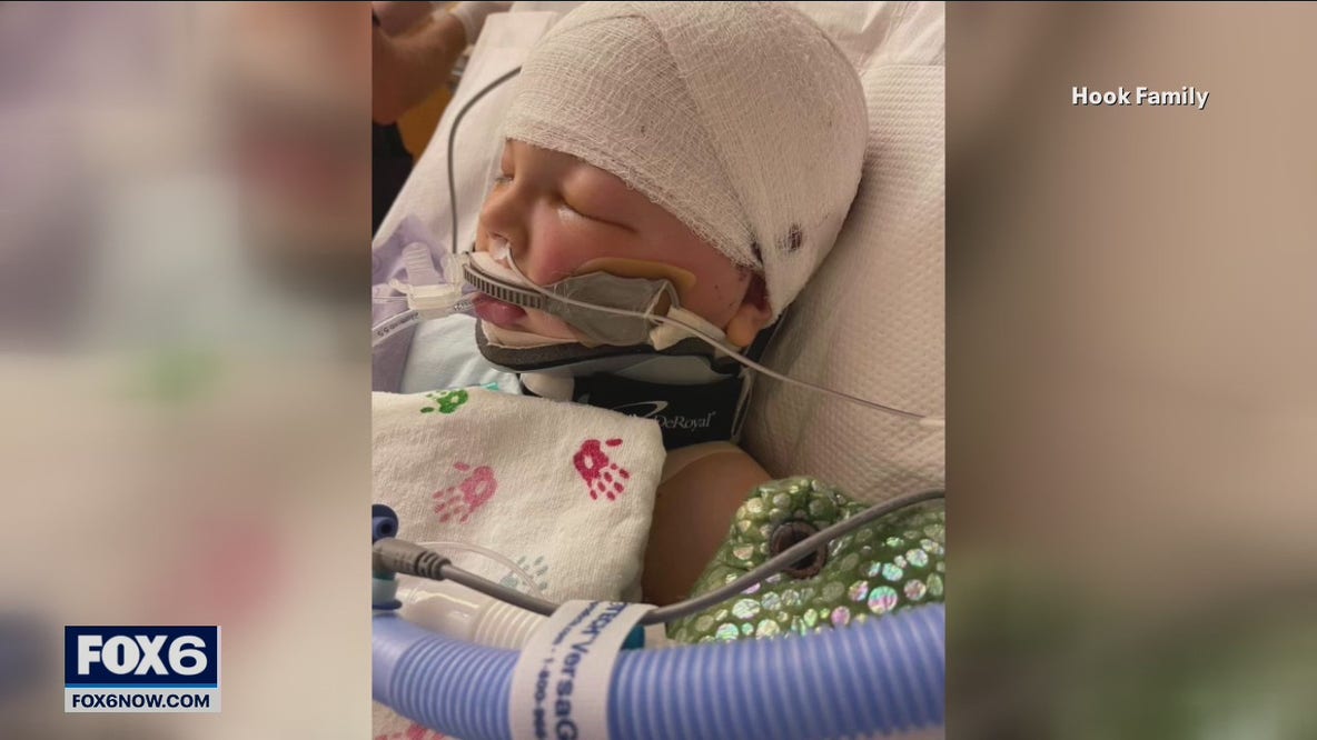 6-year-old in coma, struck by projectile at recess in Kenosha County